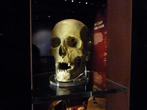 Mary Rose skull
